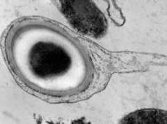 Carboxydothermus hydrogenoformans, фото с сайта Science Daily Carboxydothermus hydrogenoformans, фото с сайта Science Daily