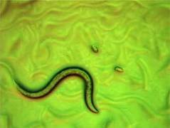 Caenorhabditis elegans, фотография с сайта steve.gb.com Caenorhabditis elegans, фотография с сайта steve.gb.com