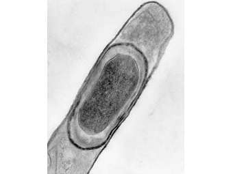  Bacillus licheniformis.    kenyon.edu